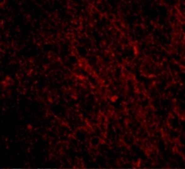 Immunofluorescence of SCO1