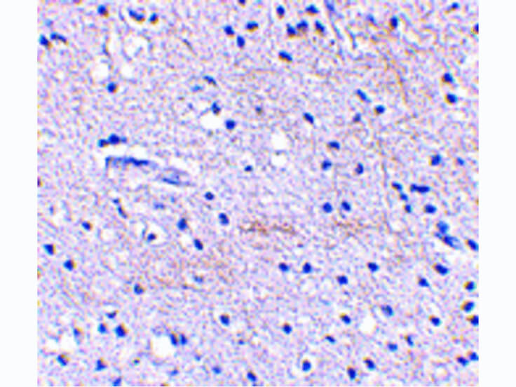 Immunohistochemistry of SCRAPPER Antibody