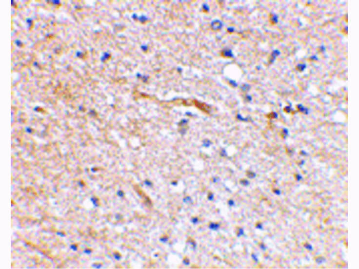 Immunohistochemistry of SCRAPPER Antibody