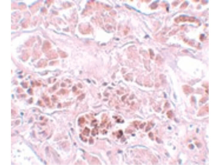 Immunohistochemistry of SCRN1 Antibody