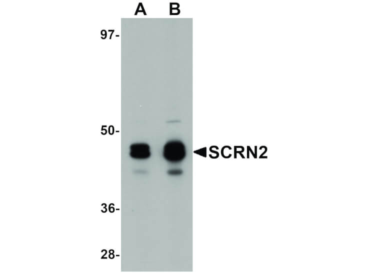 Western Blot of SCRN2 Antibody