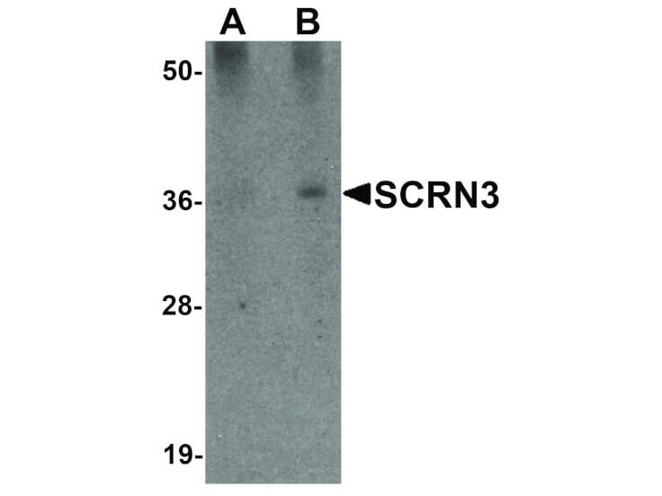 Western Blot of SCRN3 Antibody