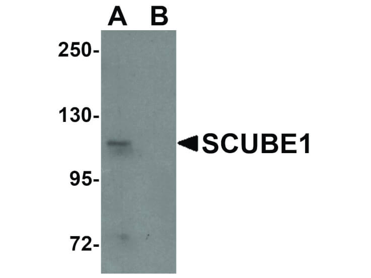 Western Blot of SCUBE3 Antibody