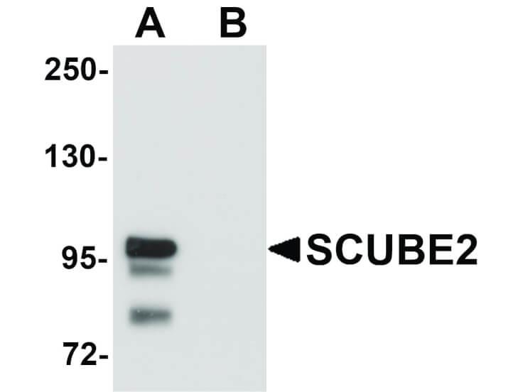 Western Blot of SCUBE2 Antibody