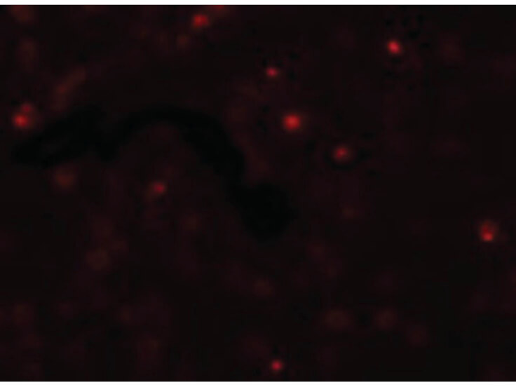 Immunofluorescence of SCUBE2 Antibody