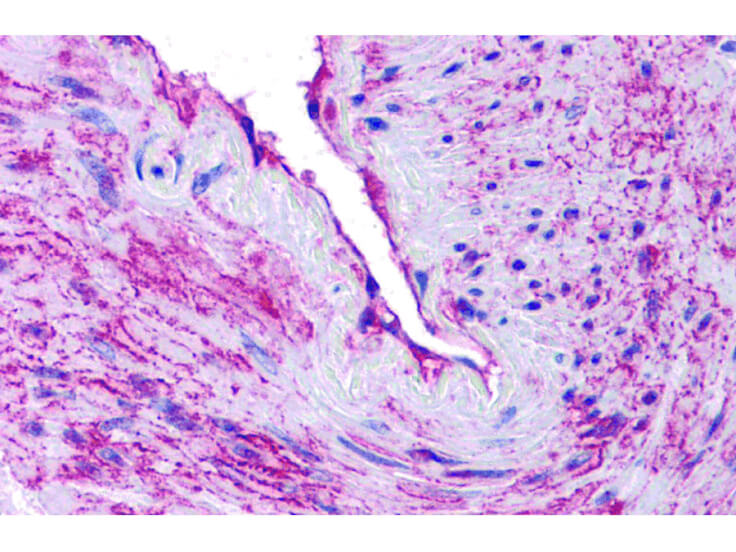 Immunohistochemistry of SCUBE3 Antibody