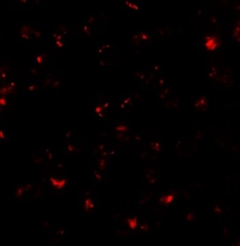 Immunofluorescence of SDHD