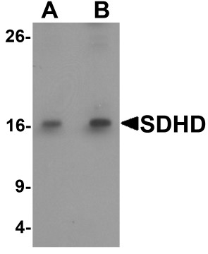 Western blot analysis of SDHD