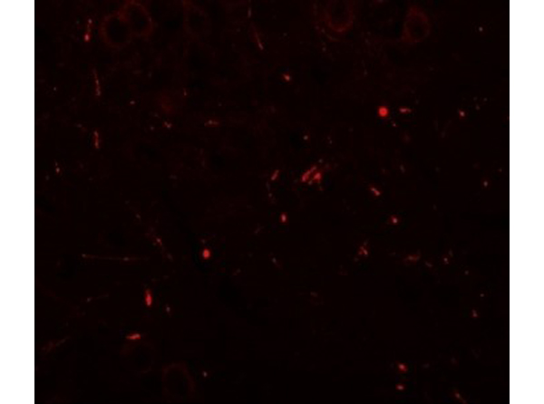 Immunofluorescence of SEC62