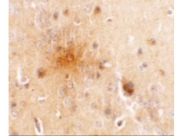 Immunohistochemistry of SEC62