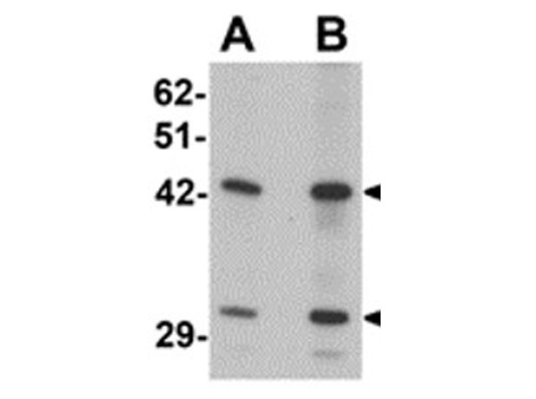 Western blot analysis of SEC62