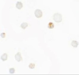 Immunocytochemistry of SEPT1