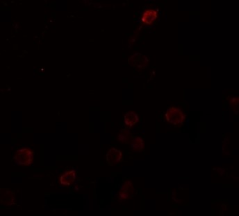 Immunofluorescence of SEPT1