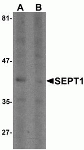 Western blot analysis of SEPT1