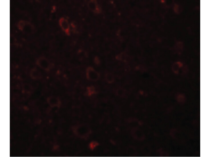 Immunofluorescence of SESTD1 Antibody