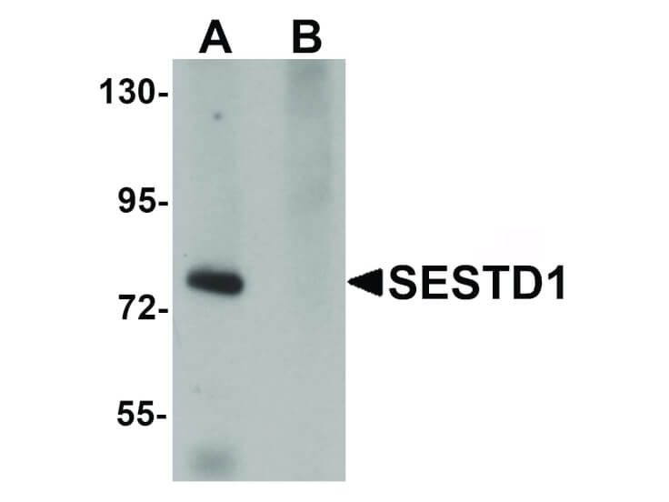 Western Blot of SESTD1 Antibody