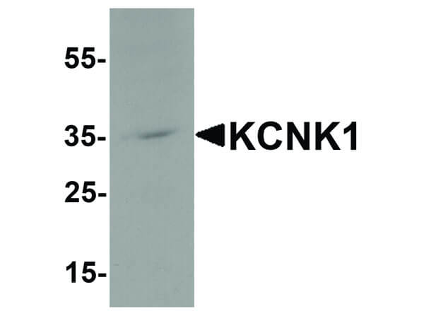 Western Blot of KCNK1 Antibody