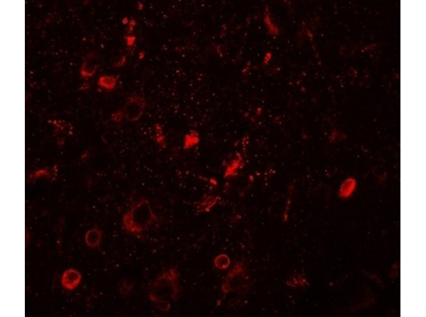 Immunofluorescence of SGSM1