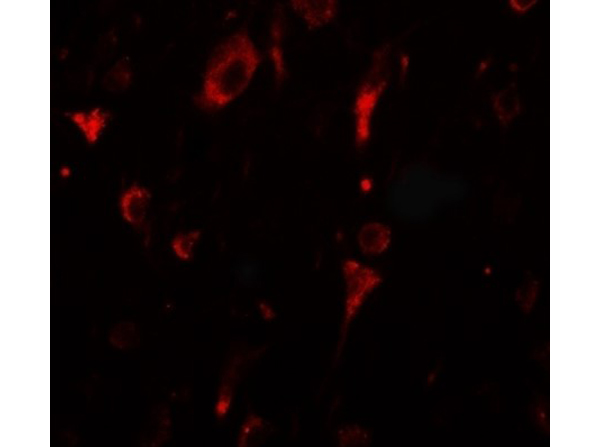 Immunofluorescence of SGSM2