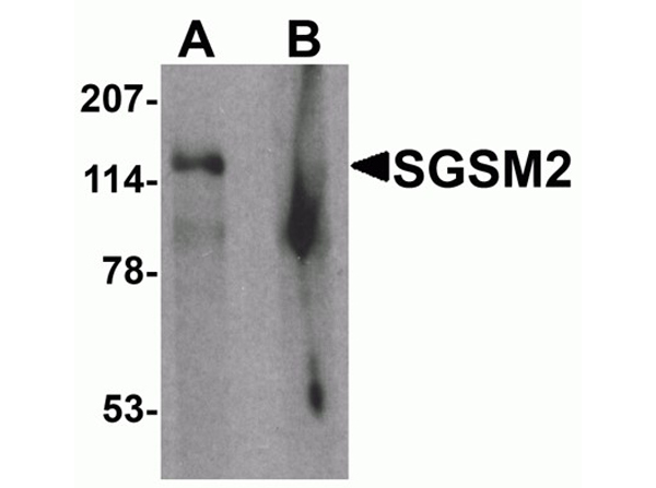 Western blot analysis of SGSM2