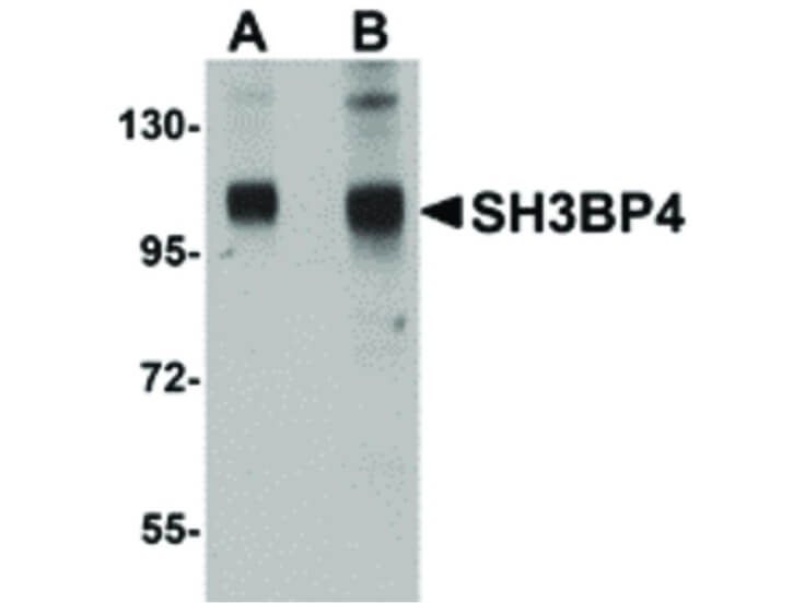 Western Blot of SH3BP4 Antibody