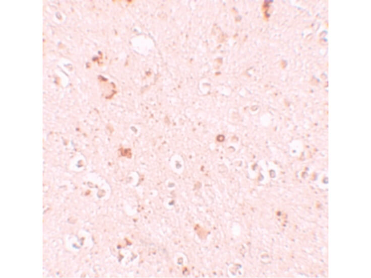 Immunohistochemistry of SH3RF2 Antibody