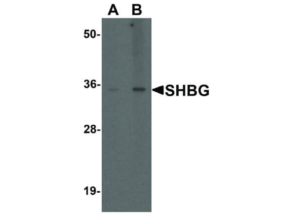 Western Blot of SHBG Antibody