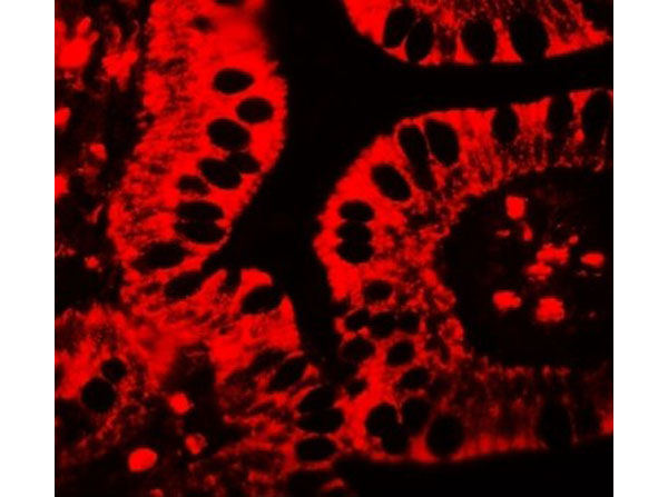 Immunofluorescence of SHISA3