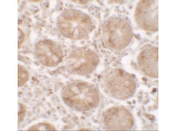 Immunohistochemistry of SHISA3