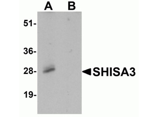 Western blot analysis of SHISA3