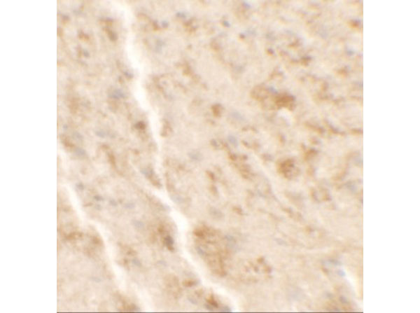 Immunohistochemistry of SHISA4