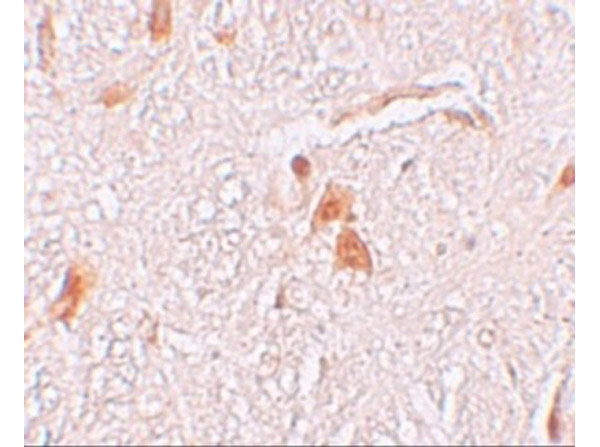 Immunohistochemistry of SHISA9