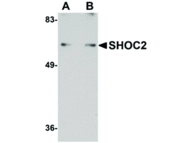 Western Blot of SHOC2 Antibody