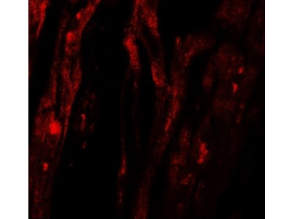 Immunofluorescence of SHQ1