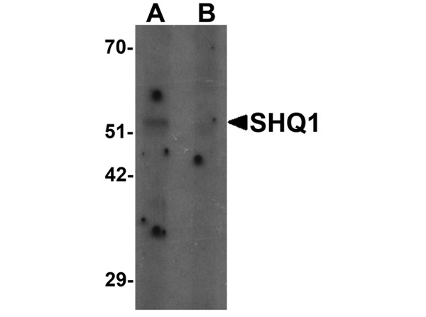 Western blot analysis of SHQ1