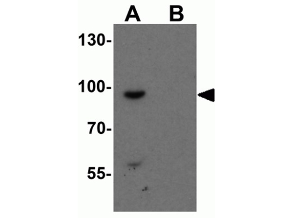 Western blot analysis of SHROOM1