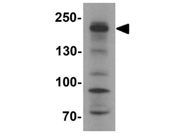 Western blot analysis of SHROOM3