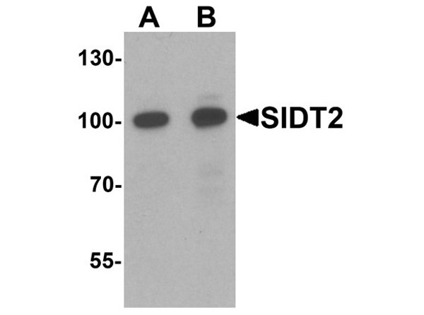 Western blot analysis of SIDT2