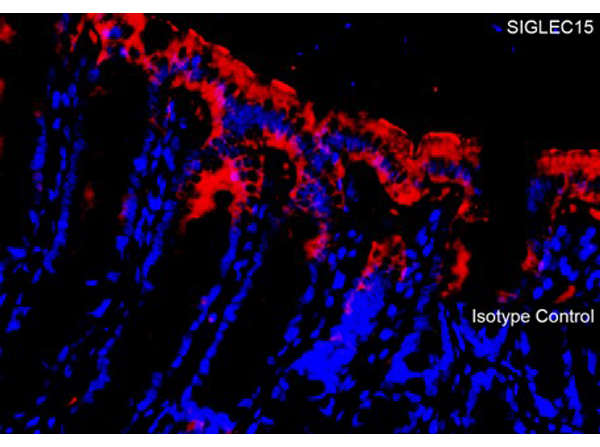 Immunofluorescence of SIGLEC15