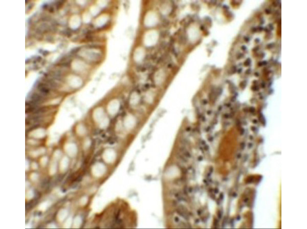 Immunohistochemistry of SIK1