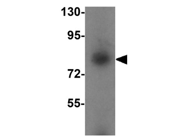 Western blot analysis of SIK1