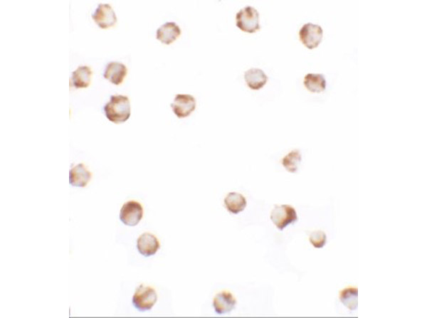 Immunocytochemistry of SIK2
