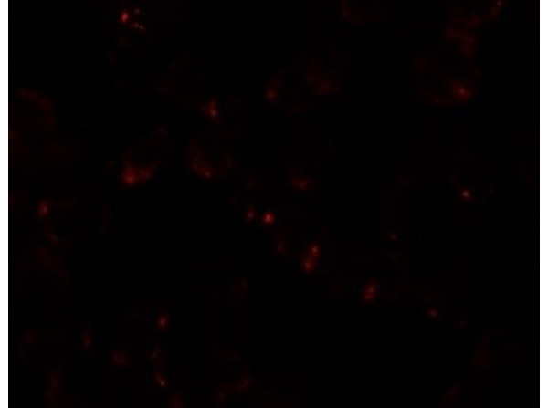 Immunofluorescence of SIK2