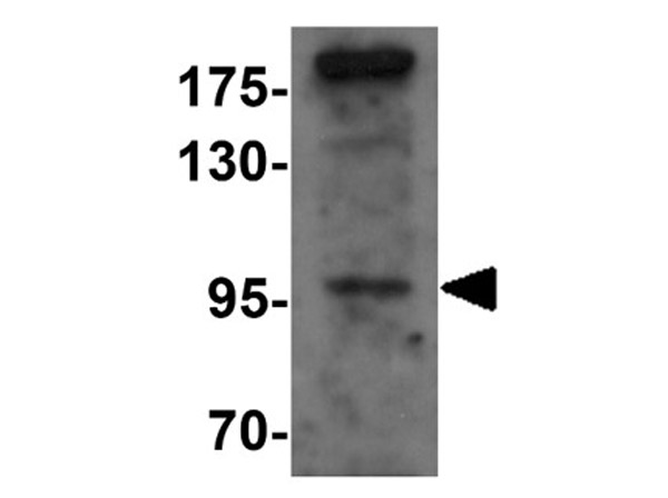 Western blot analysis of SIK2
