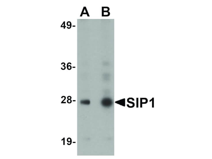 Western Blot of SIP1 Antibody