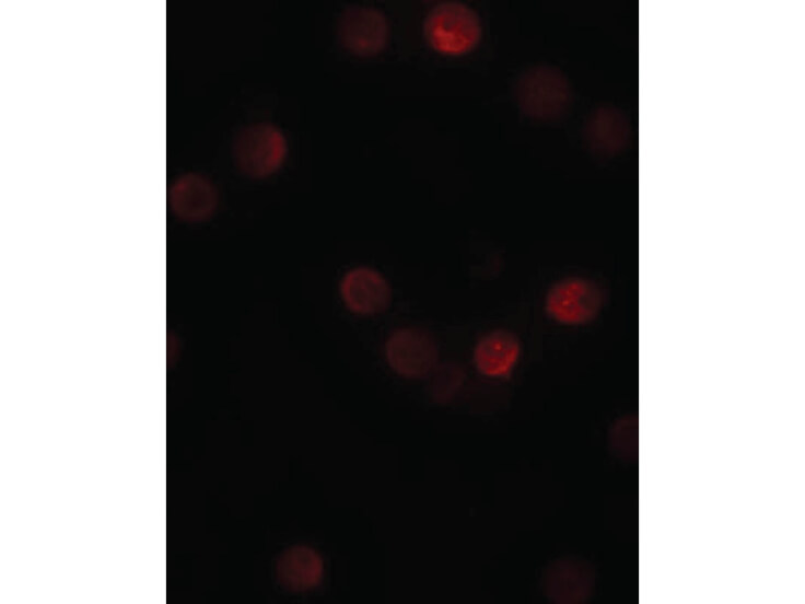 Immunofluorescence of SIP1 Antibody