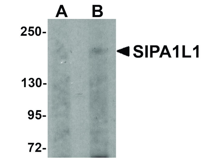 Western Blot of SIPA1L1 Antibody
