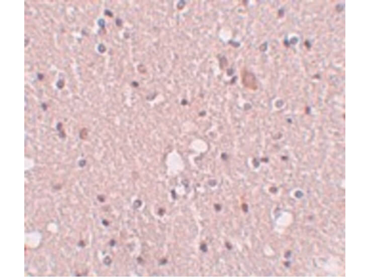 Immunohistochemistry of SIPA1L2 Antibody