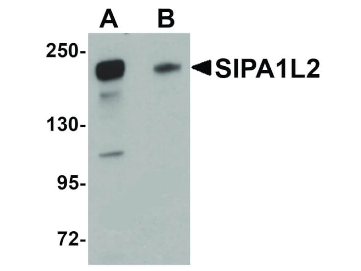 Western Blot of SIPA1L2 Antibody