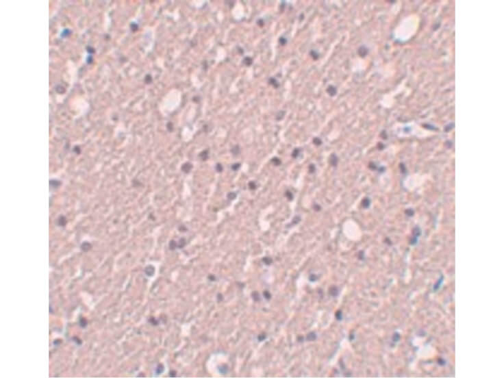 Immunohistochemistry of SIPA1L3 Antibody